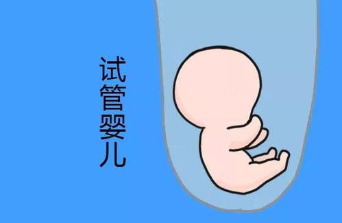 冷冻设备